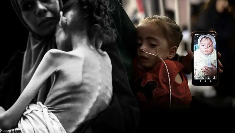 Küçük Meryem'in Acıklı Hikayesi: 25 Kilodan 10 Kiloya Düştü!
