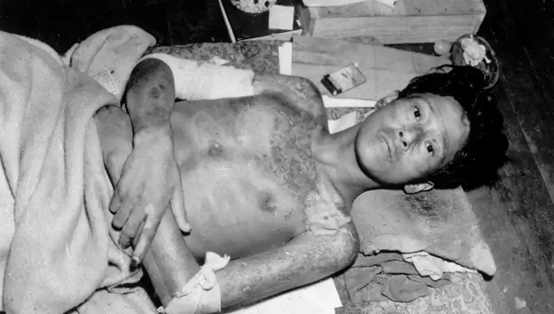 80 Yıl Sonra Nagasaki’den İkaz: Nükleer Felaket Tehdidi Geri Döndü